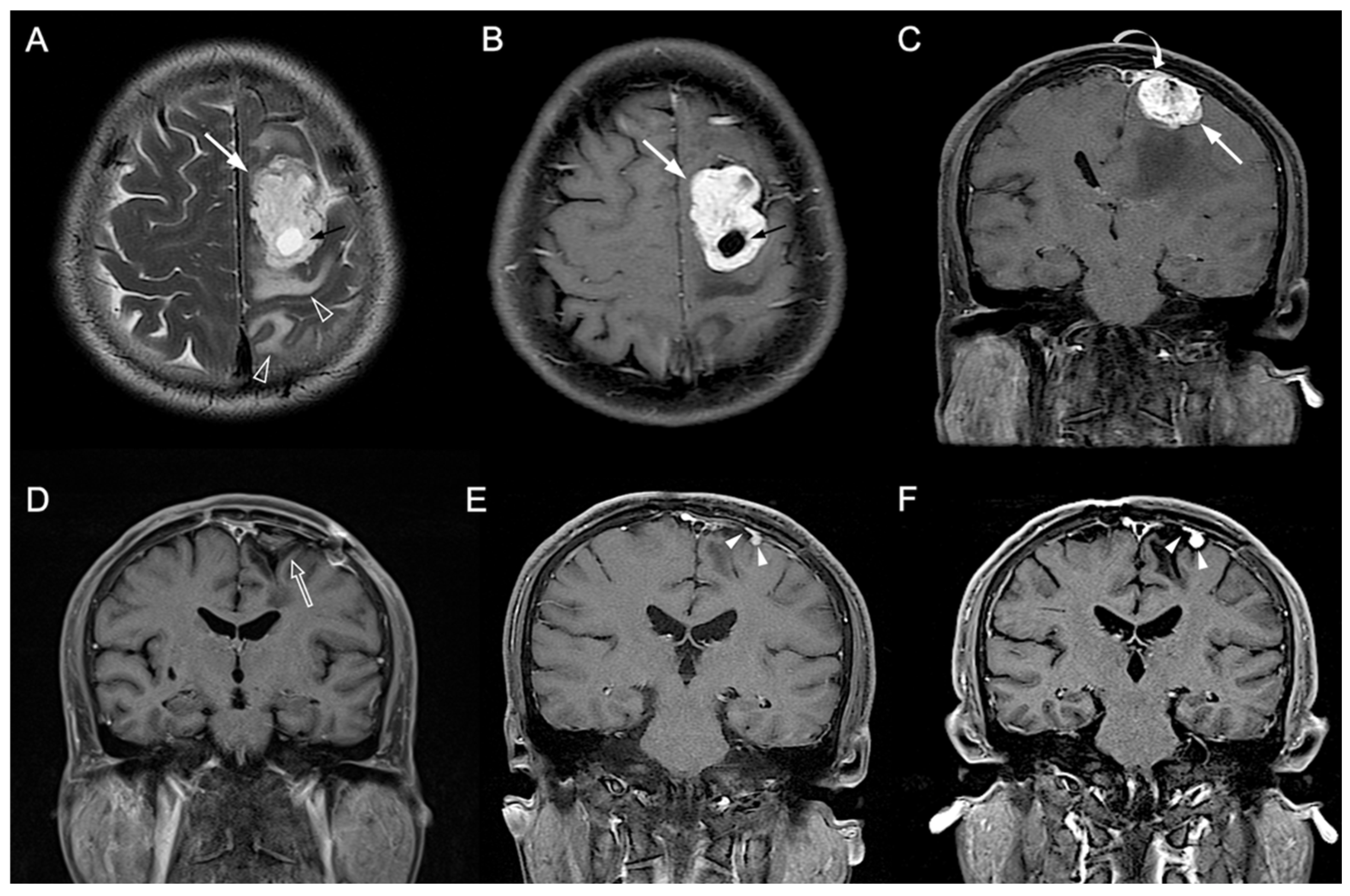 Jpm 12 00522 g003 Jpm 12 00522 g003