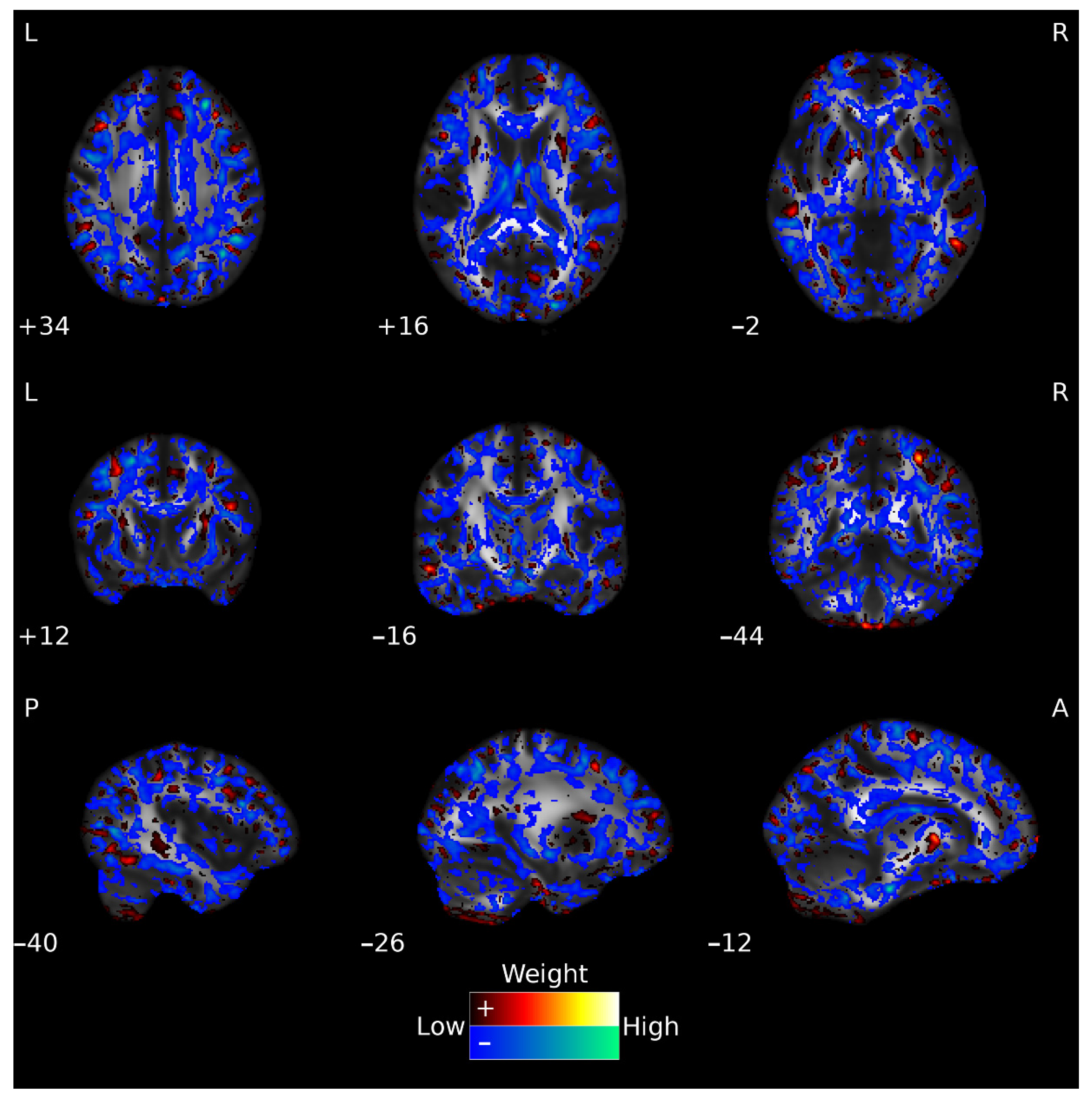 Jpm 12 00704 g003 Jpm 12 00704 g003