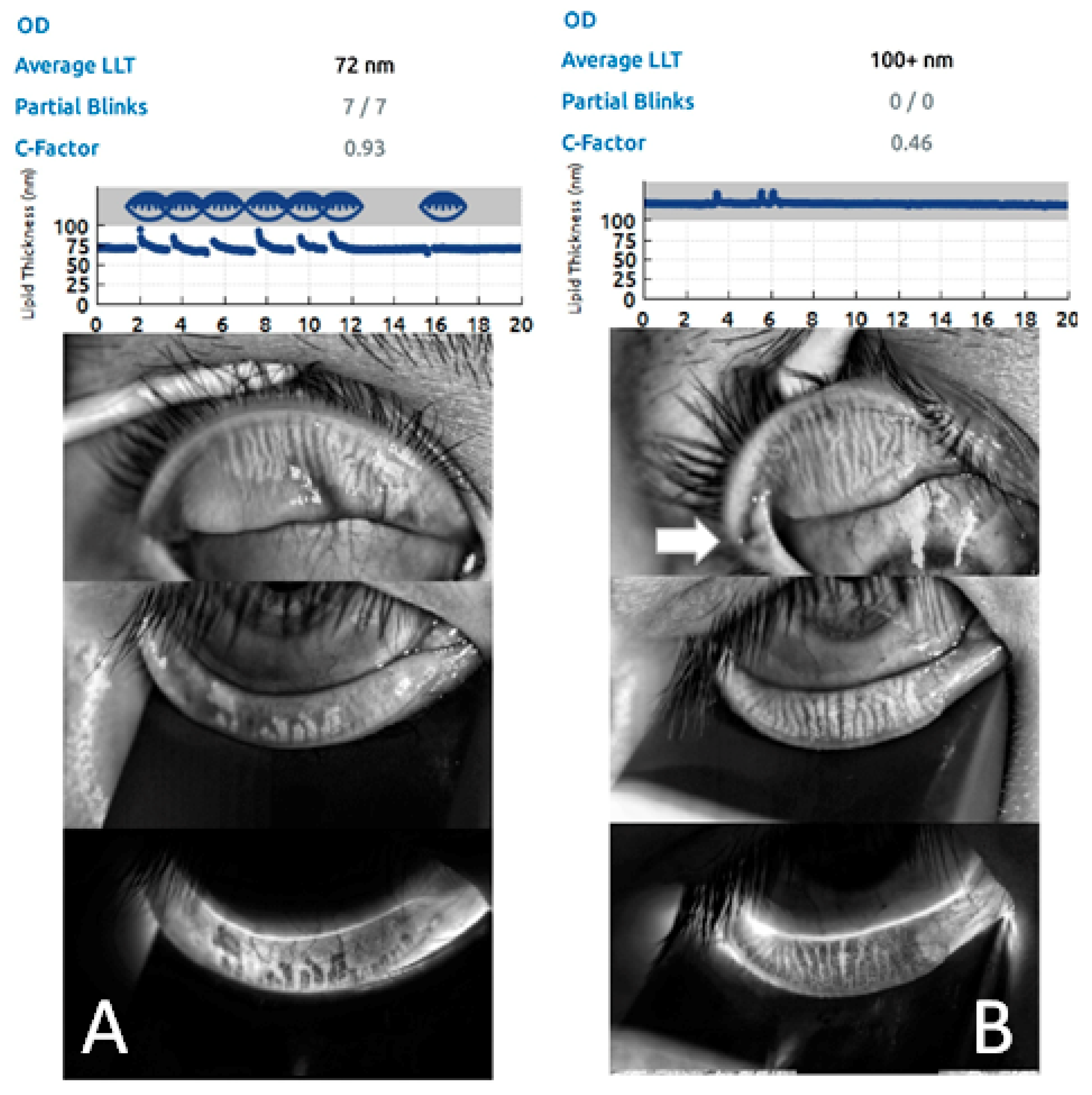 Jpm 12 00802 g003 Jpm 12 00802 g003