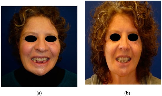 Jpm 12 00934 g001 550