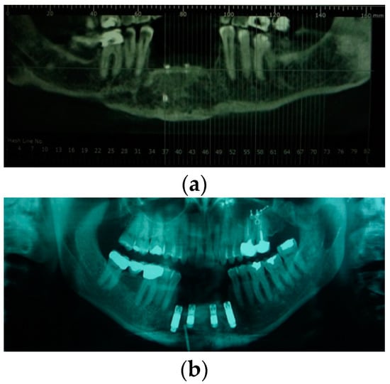 Jpm 12 00934 g002 550