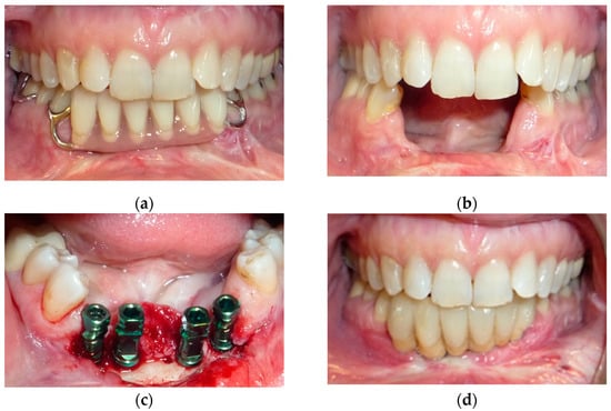 Jpm 12 00934 g003 550