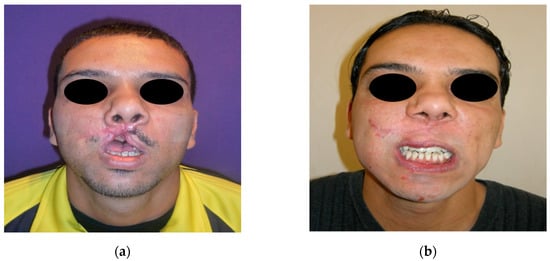 Jpm 12 00934 g004 550