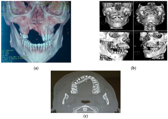 Jpm 12 00934 g005 550