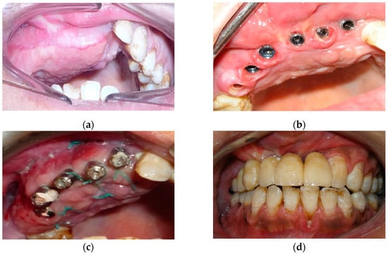 Jpm 12 00934 g006 550