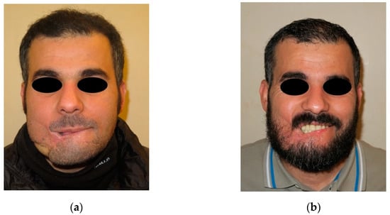 Jpm 12 00934 g007 550