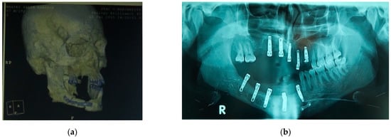 Jpm 12 00934 g008 550