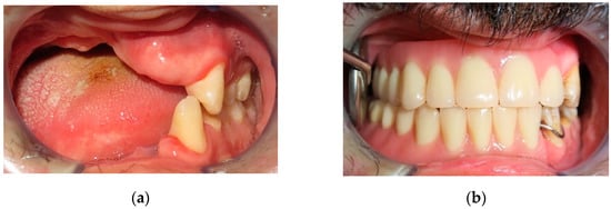 Jpm 12 00934 g009a 550