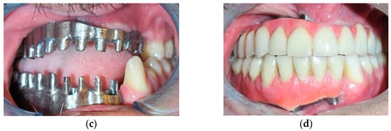 Jpm 12 00934 g009b 550