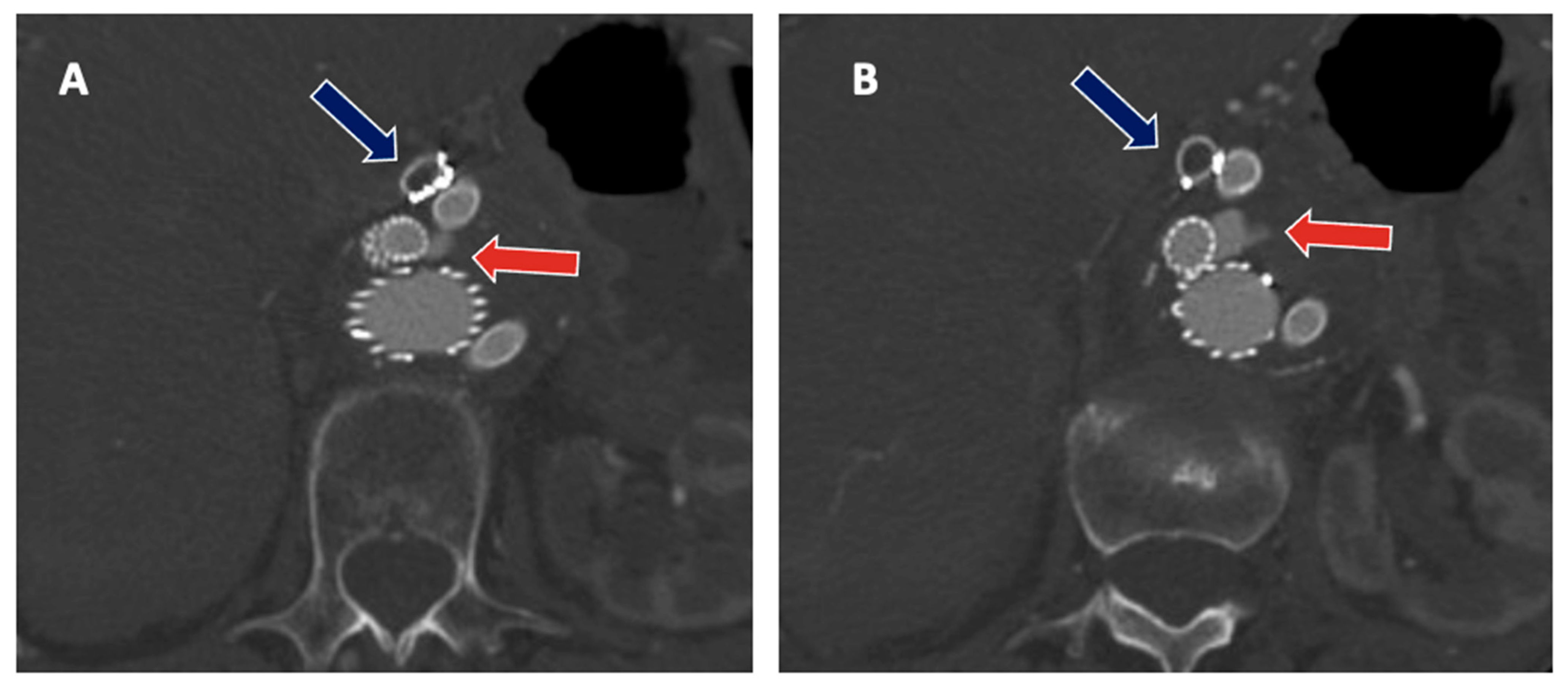 Jpm 12 01018 g003 Jpm 12 01018 g003