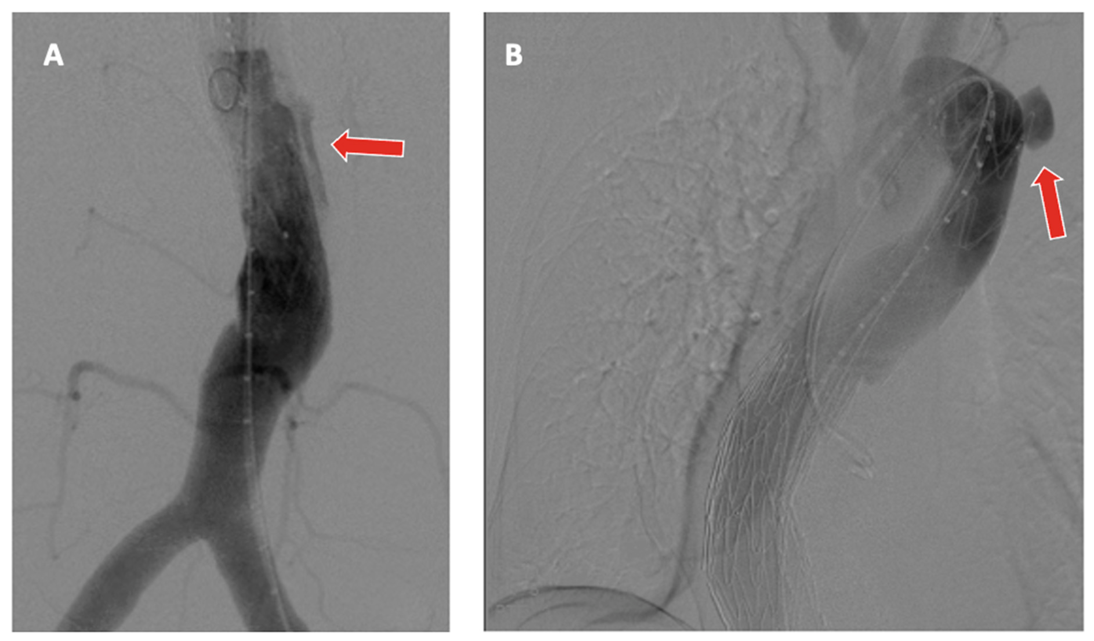 Jpm 12 01018 g004 Jpm 12 01018 g004
