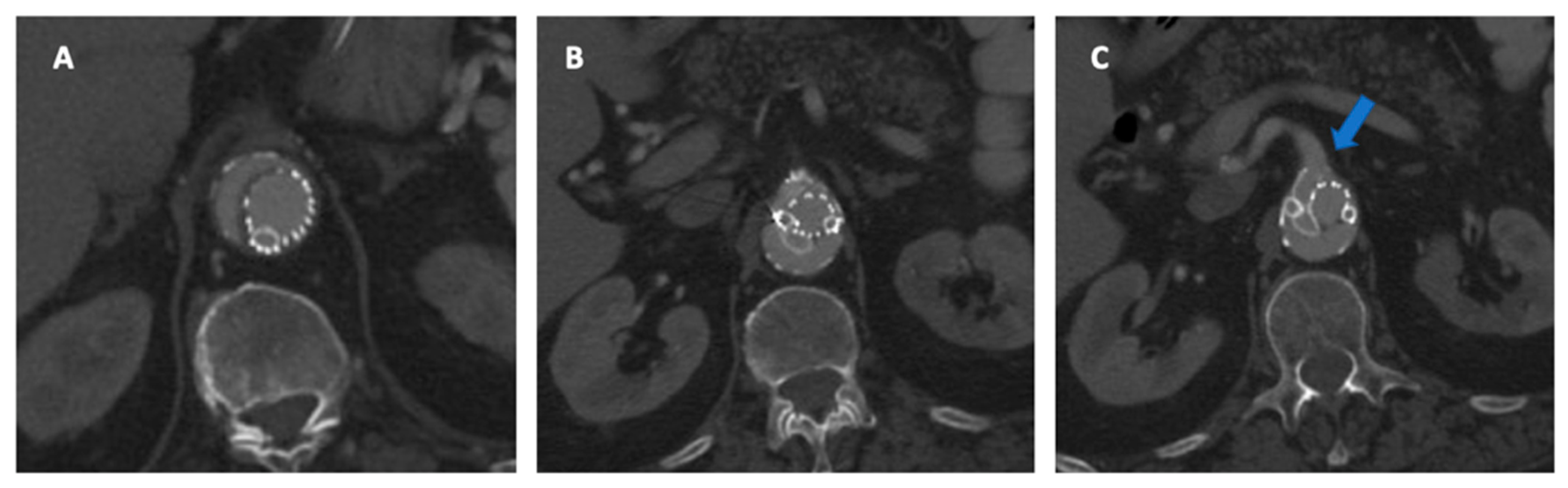 Jpm 12 01018 g007 Jpm 12 01018 g007