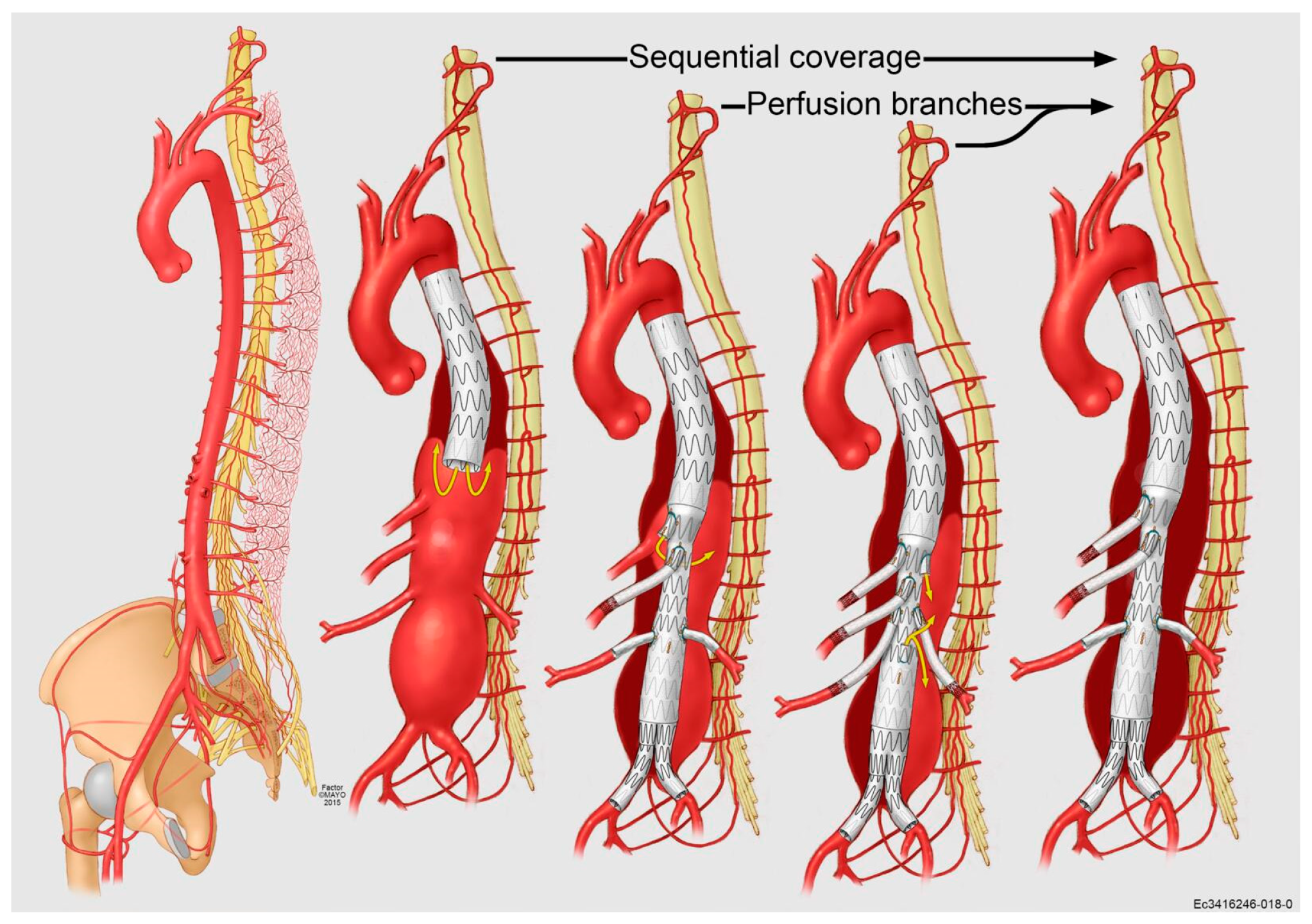 Jpm 12 01018 g008 Jpm 12 01018 g008