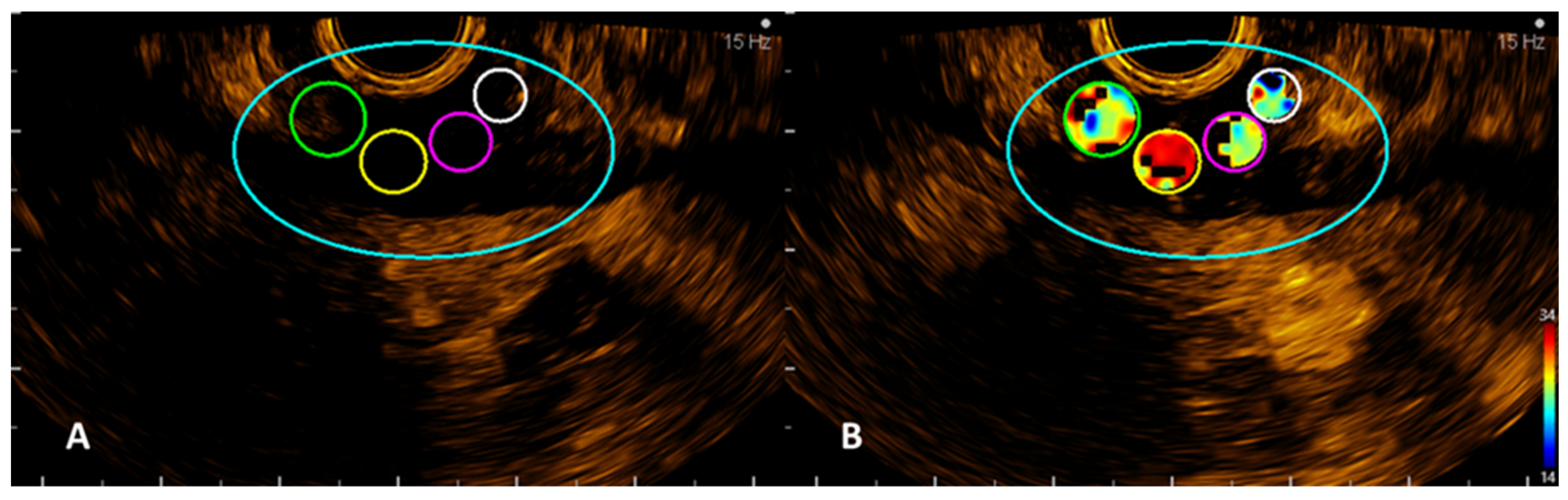 Jpm 12 01020 g002 Jpm 12 01020 g002