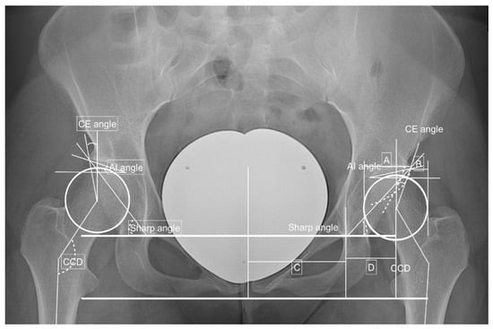 Jpm 12 01129 g001 550