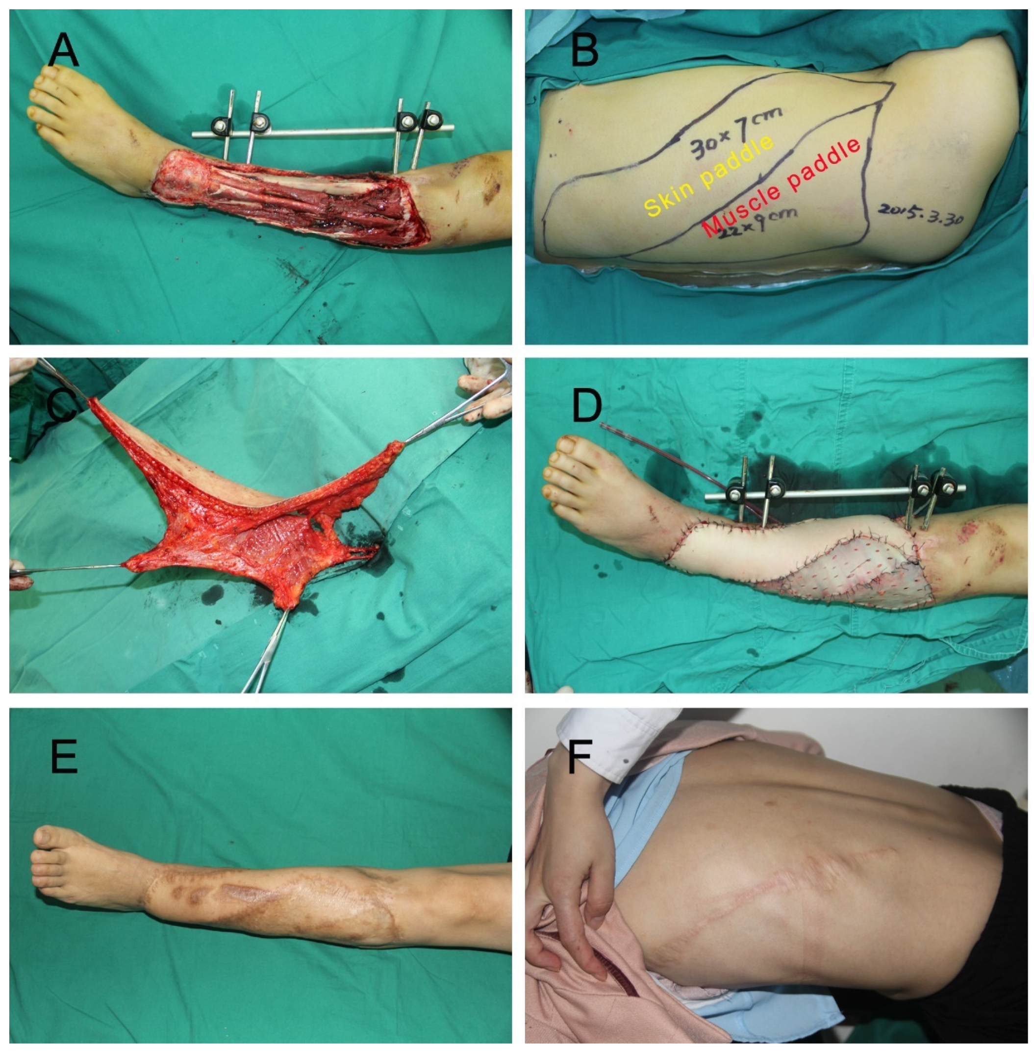 Jpm 12 01400 g002 Jpm 12 01400 g002