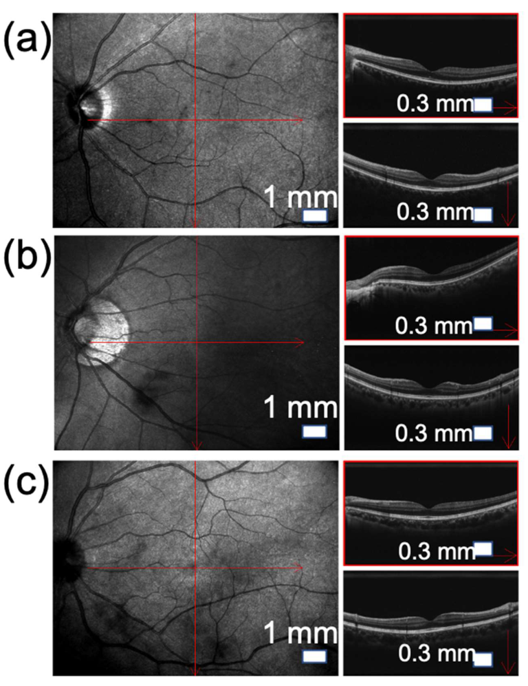 Jpm 12 01659 g004 Jpm 12 01659 g004