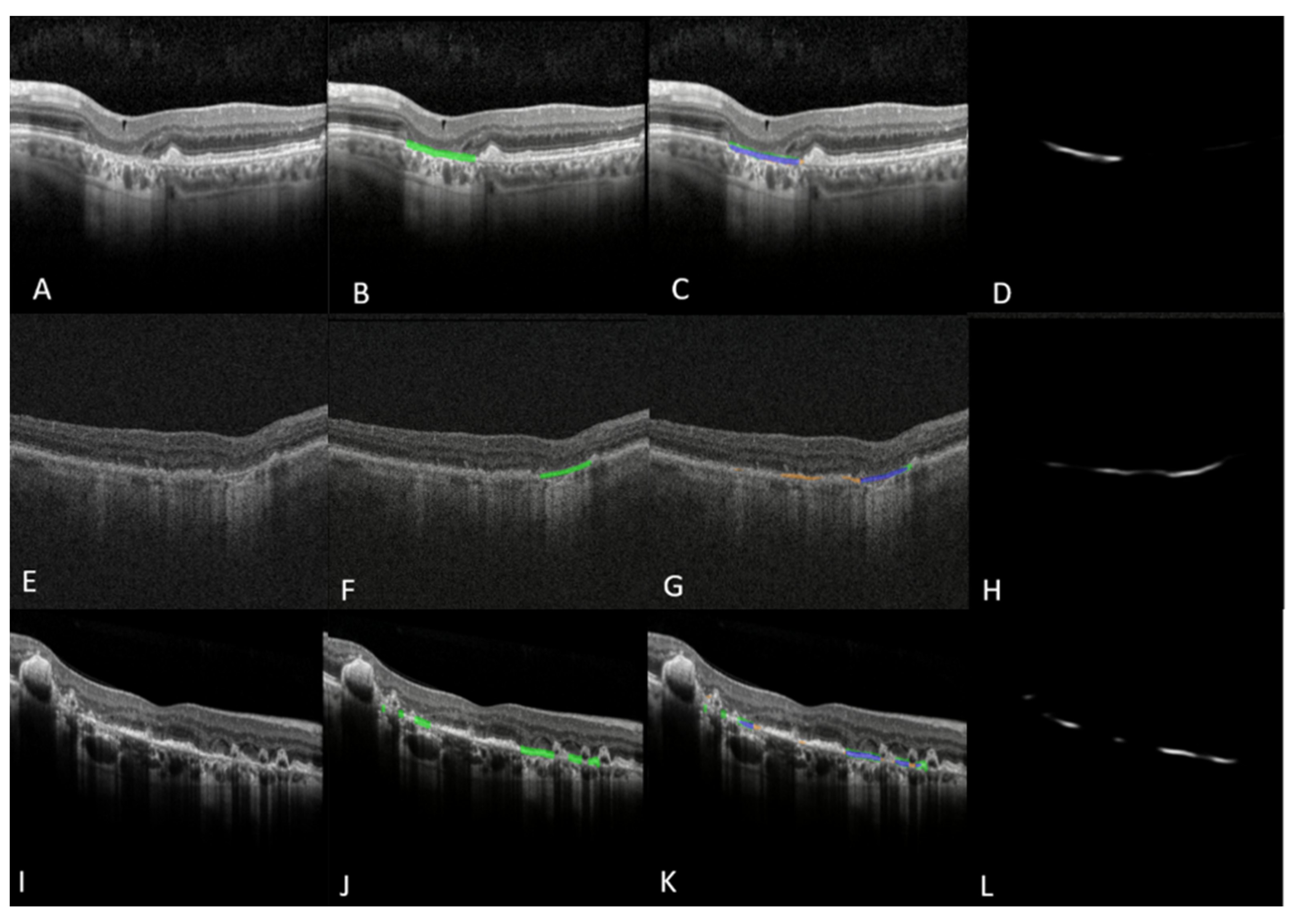 Jpm 13 00037 g004 Jpm 13 00037 g004