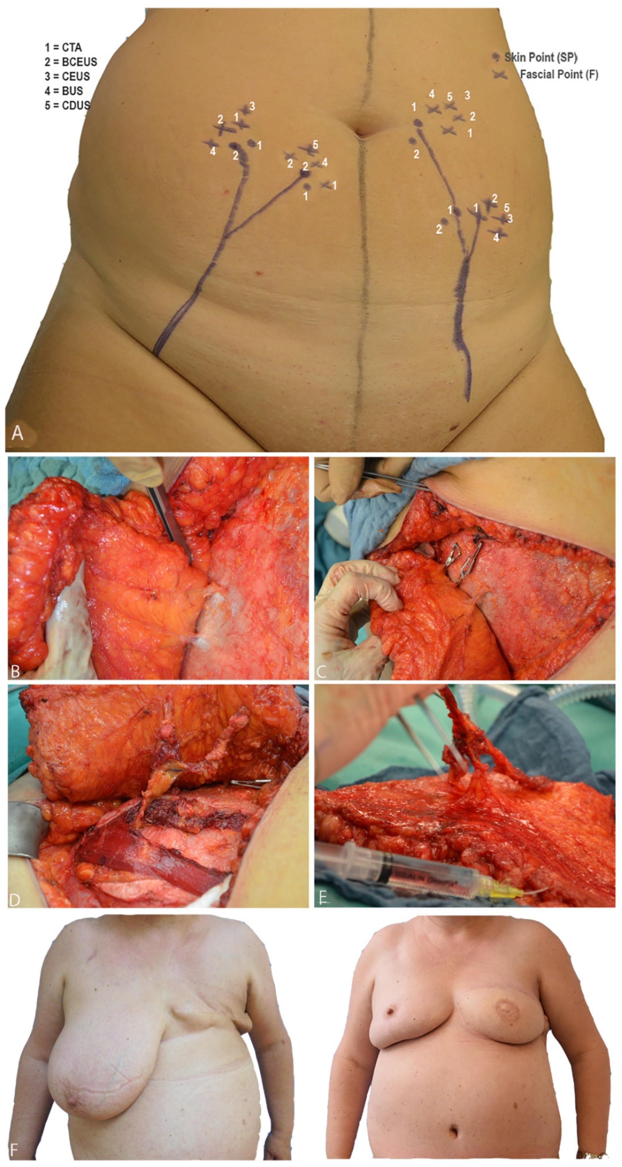 Jpm 13 00064 g004 Jpm 13 00064 g004