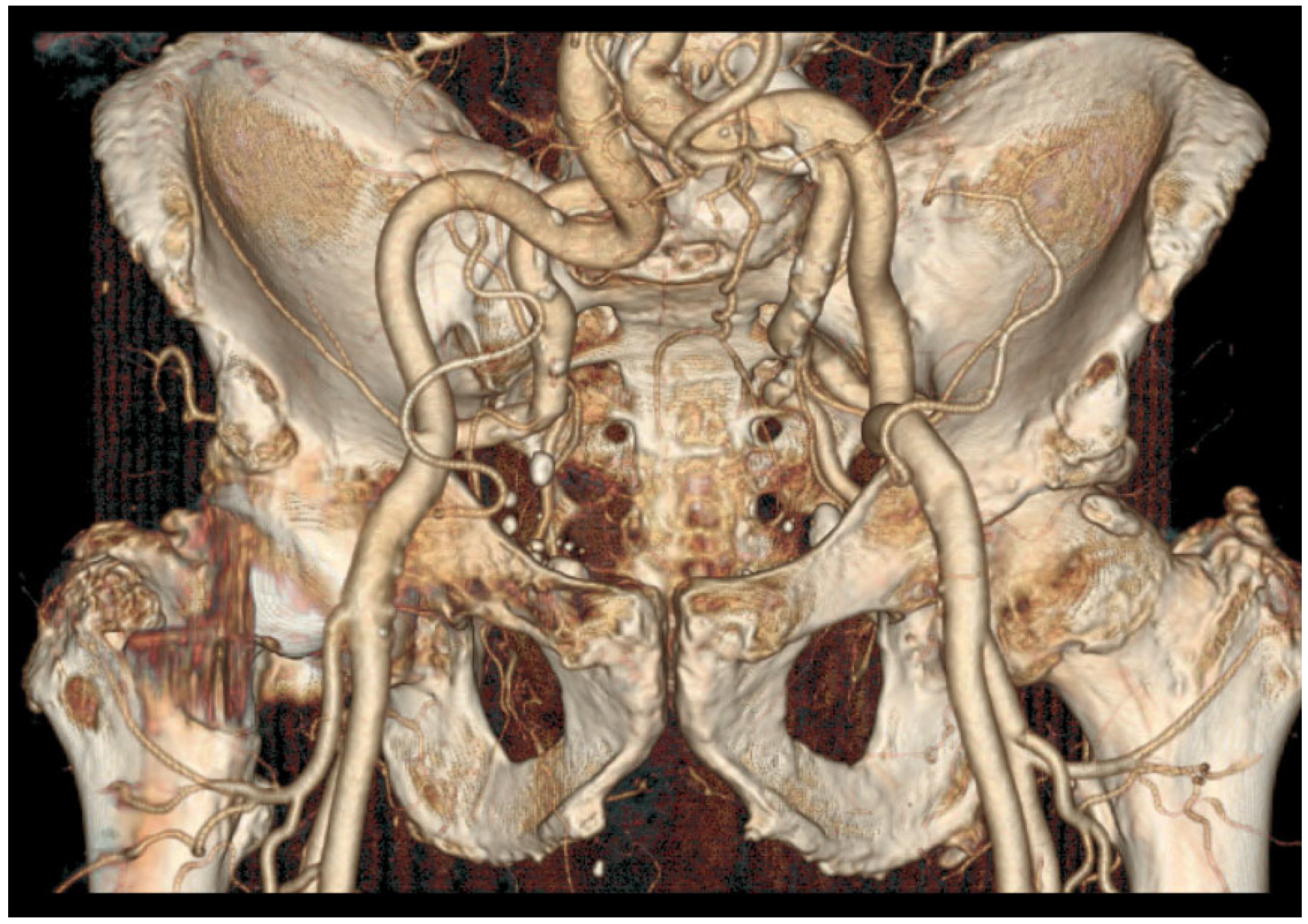 Jpm 13 00087 g001 Jpm 13 00087 g001