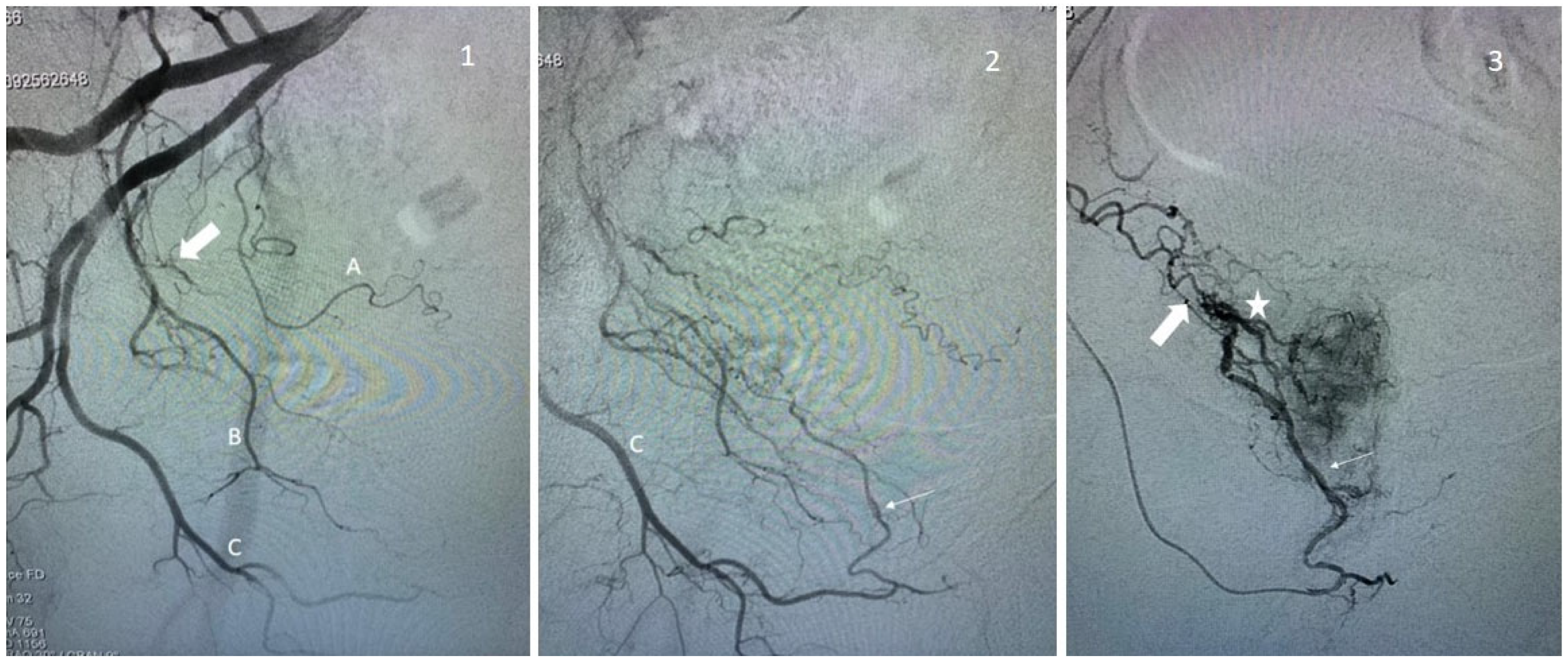 Jpm 13 00087 g003 Jpm 13 00087 g003