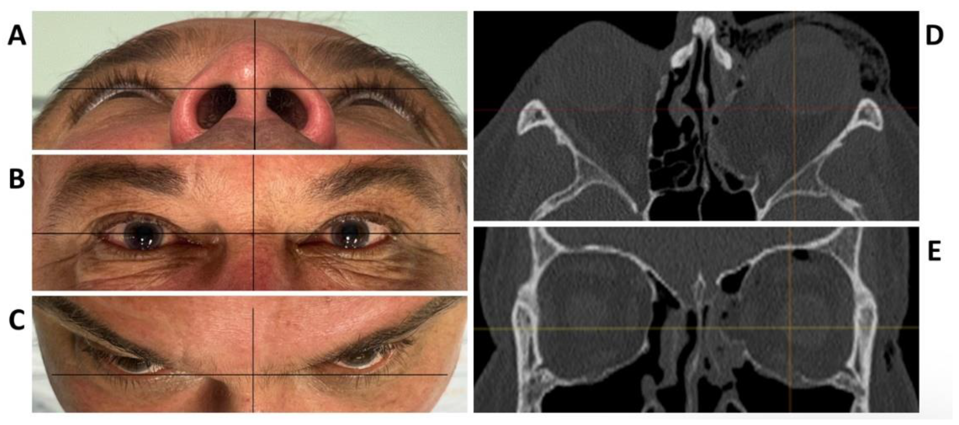 Jpm 13 00148 g001 Jpm 13 00148 g001