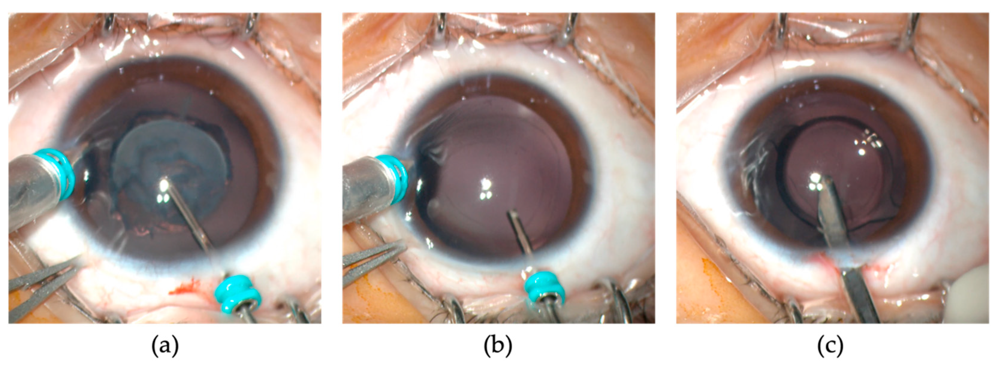 Jpm 13 00189 g001 Jpm 13 00189 g001