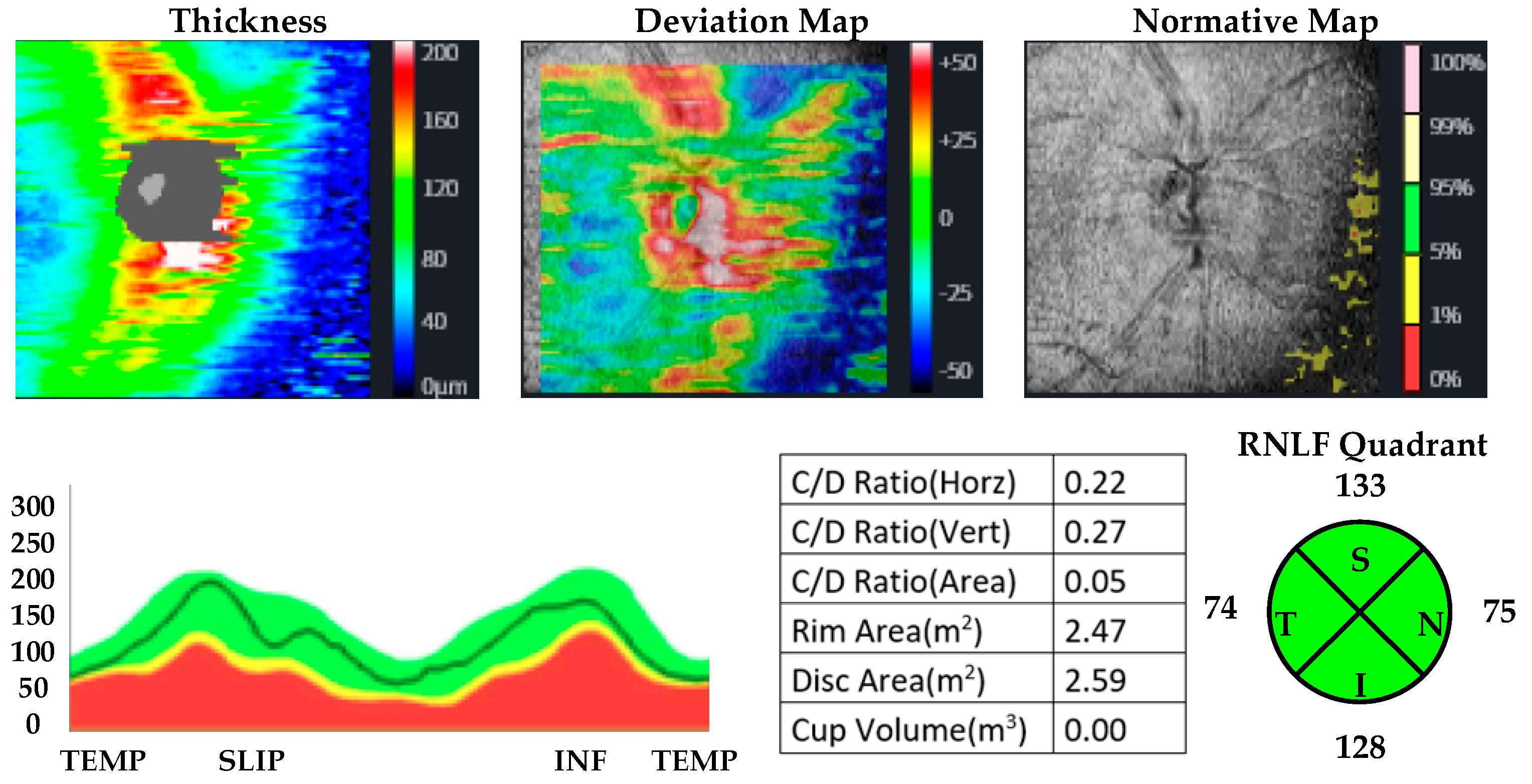 Jpm 13 00308 g002 Jpm 13 00308 g002