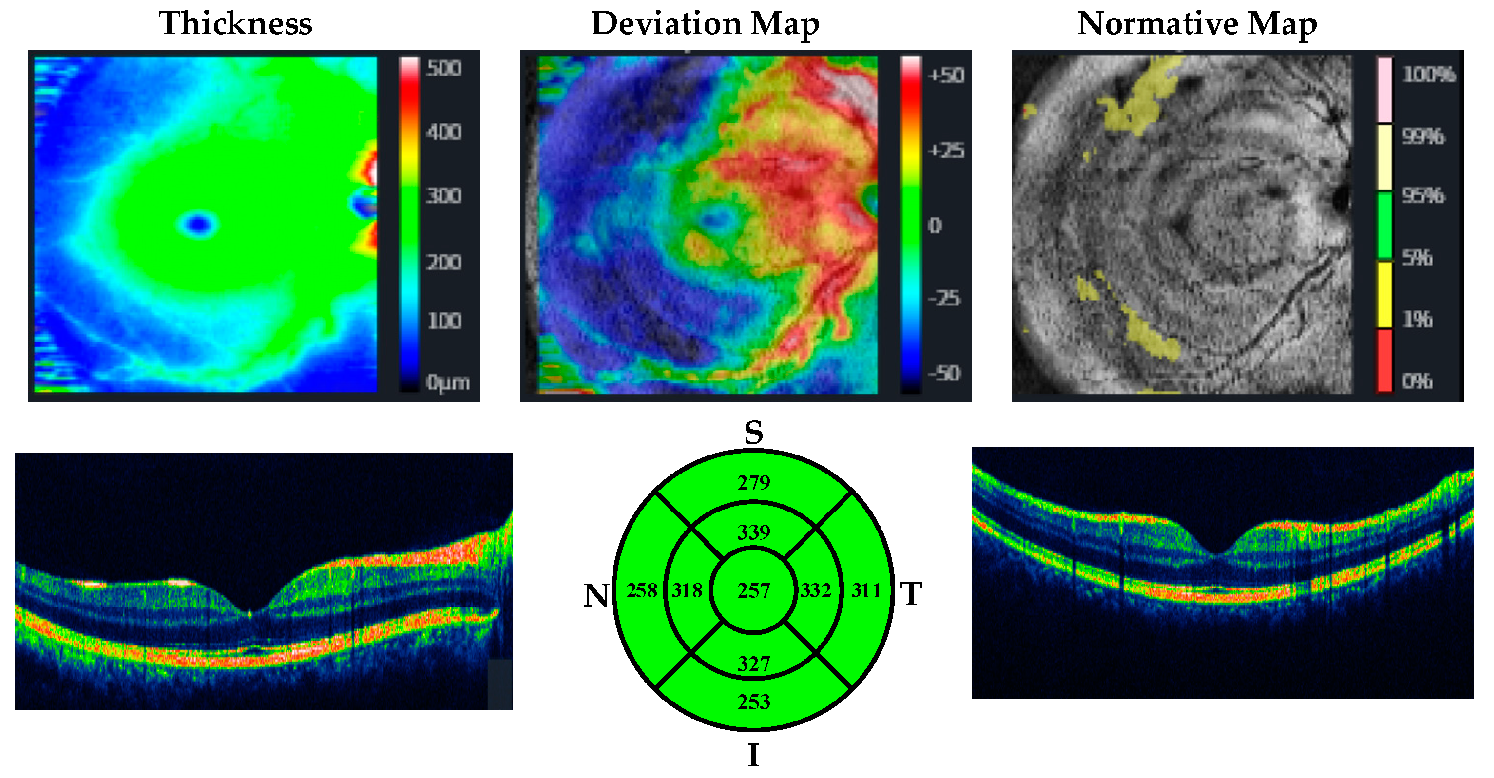 Jpm 13 00308 g003 Jpm 13 00308 g003