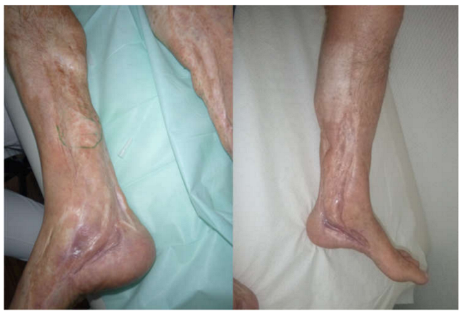 Jpm 13 00313 g001 Jpm 13 00313 g001