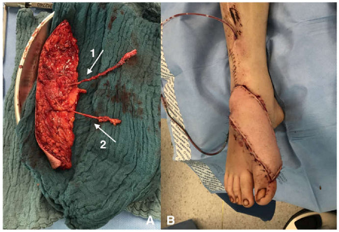 Jpm 13 00313 g002 Jpm 13 00313 g002