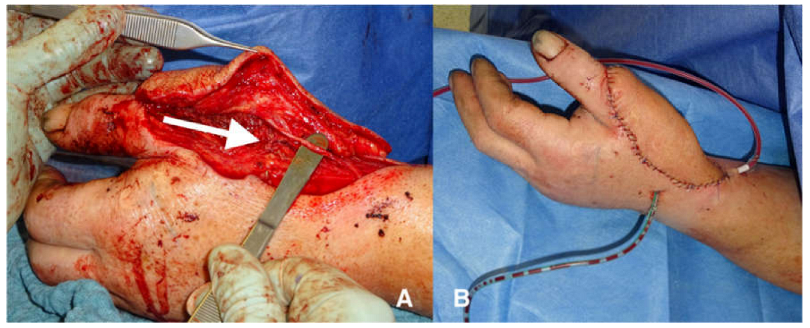 Jpm 13 00313 g003 Jpm 13 00313 g003