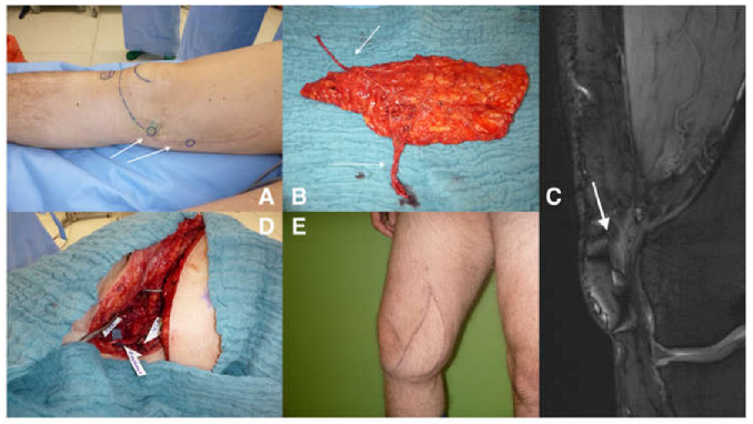 Jpm 13 00313 g004 Jpm 13 00313 g004
