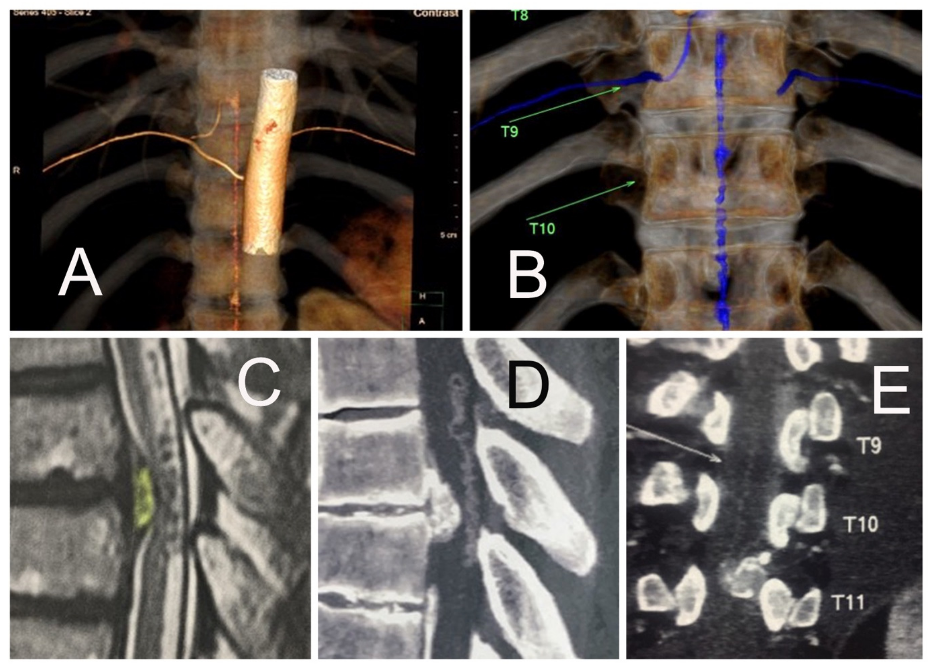 Jpm 13 00356 g002 Jpm 13 00356 g002
