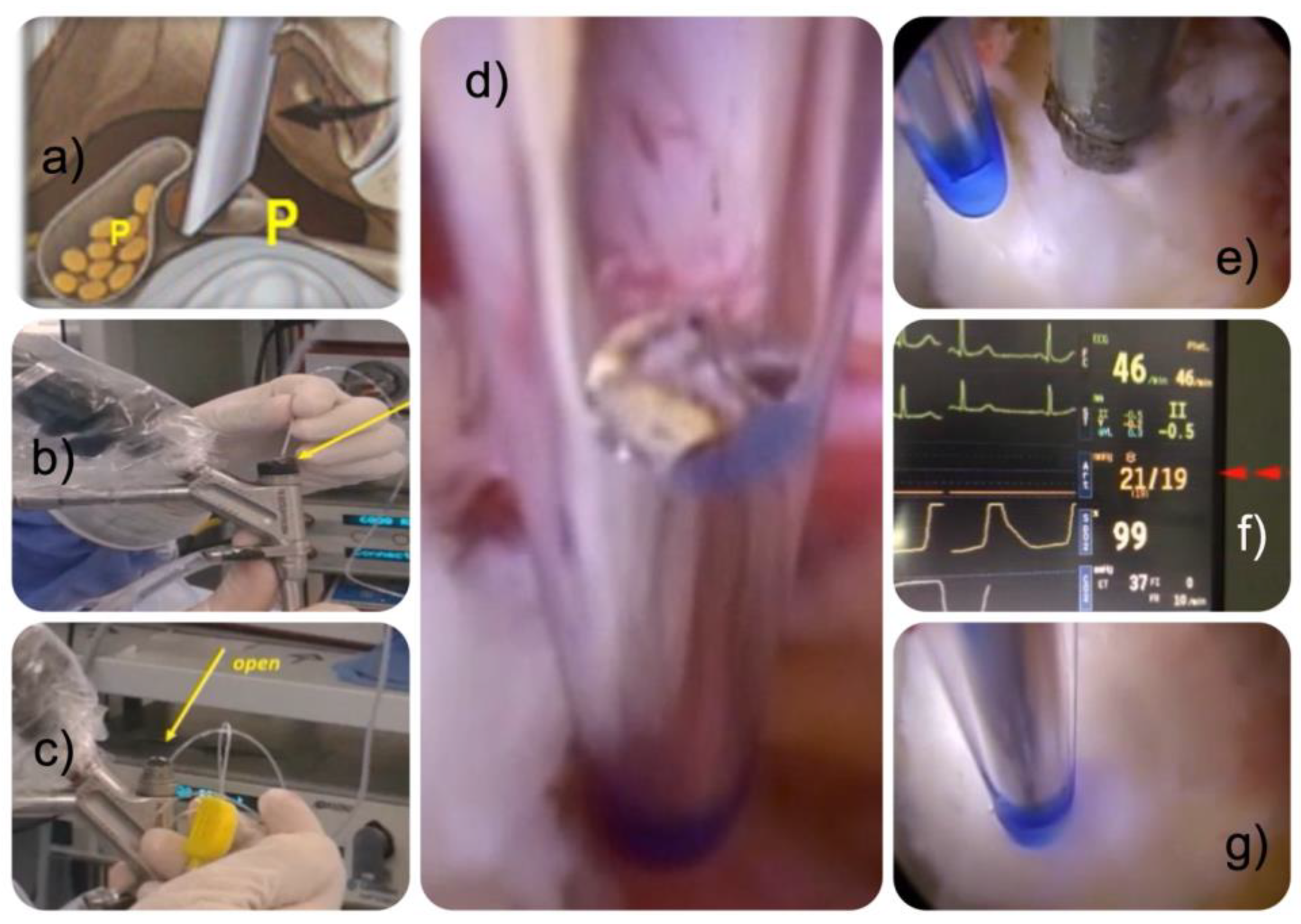 Jpm 13 00381 g002 Jpm 13 00381 g002
