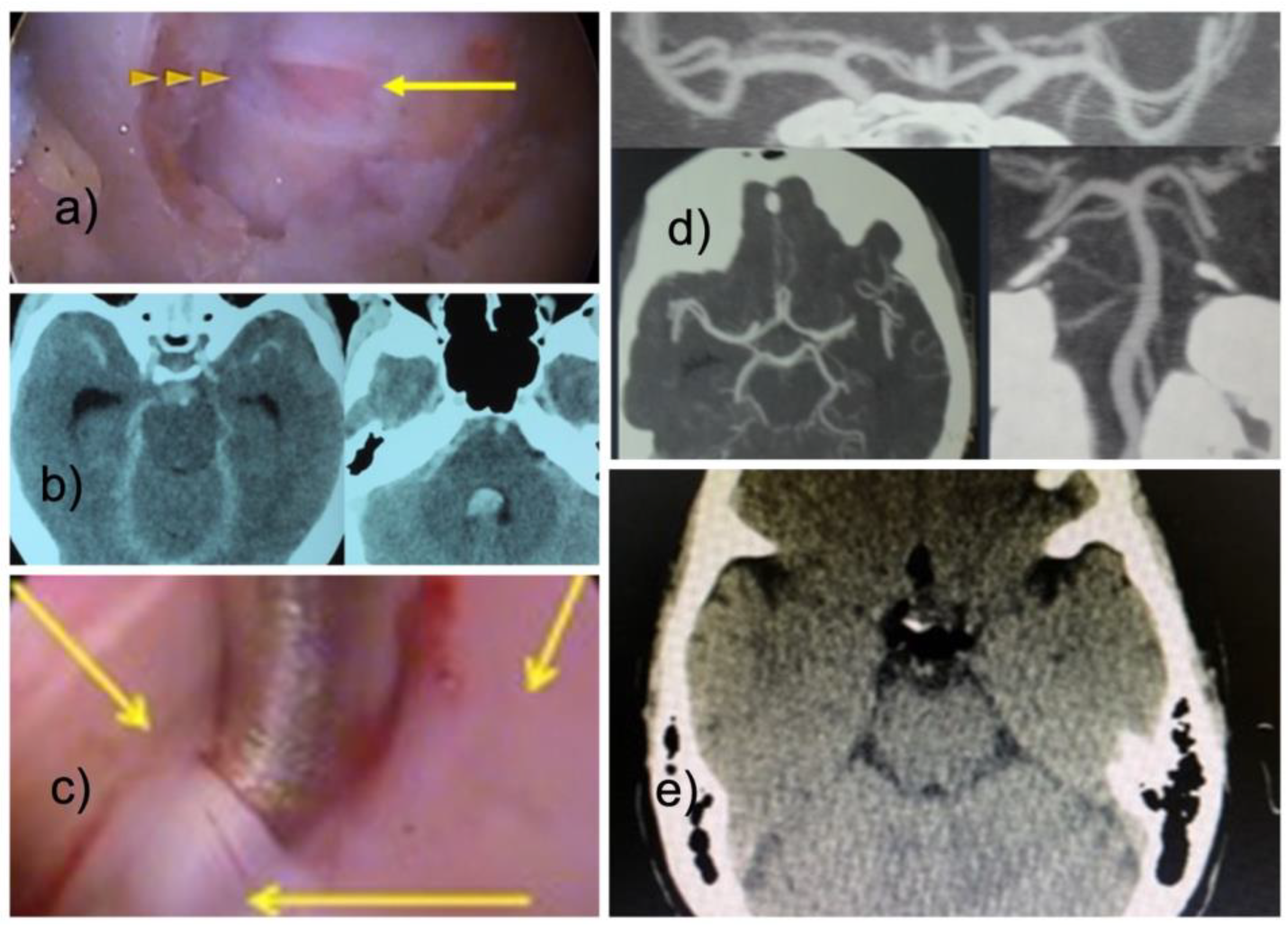 Jpm 13 00381 g003 Jpm 13 00381 g003