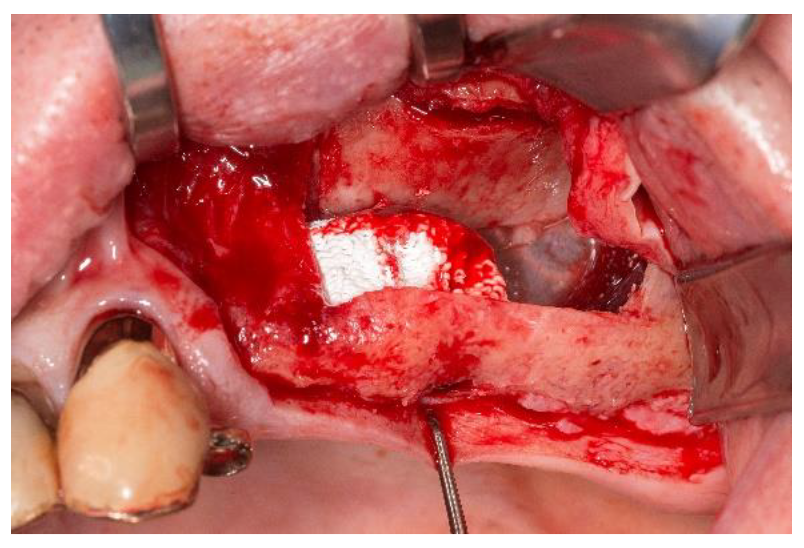 Jpm 13 00464 g003 Jpm 13 00464 g003