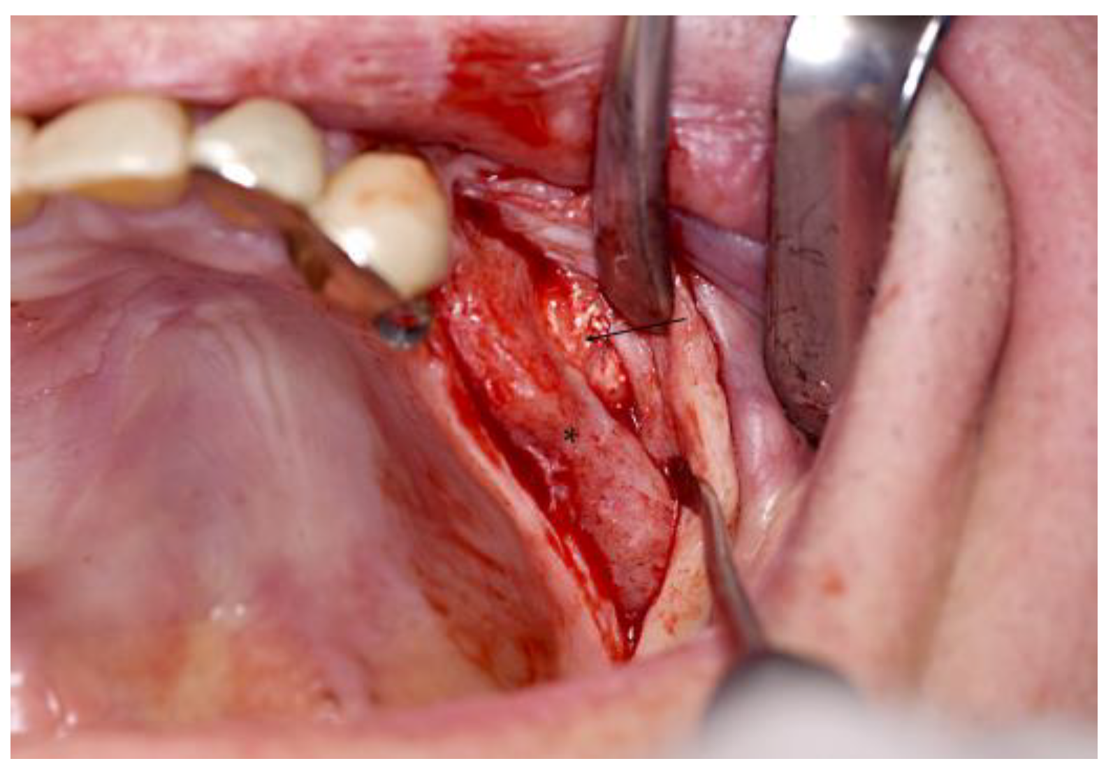 Jpm 13 00464 g004 Jpm 13 00464 g004