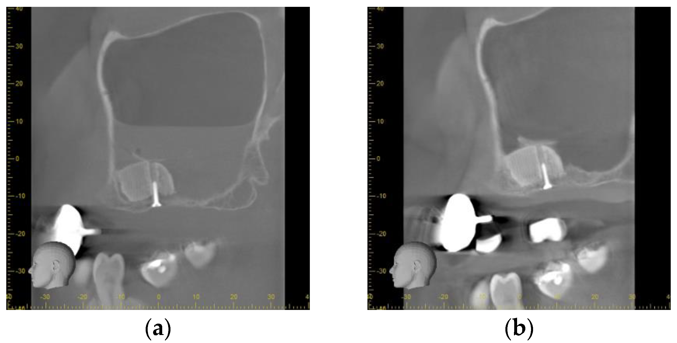 Jpm 13 00464 g005a Jpm 13 00464 g005a