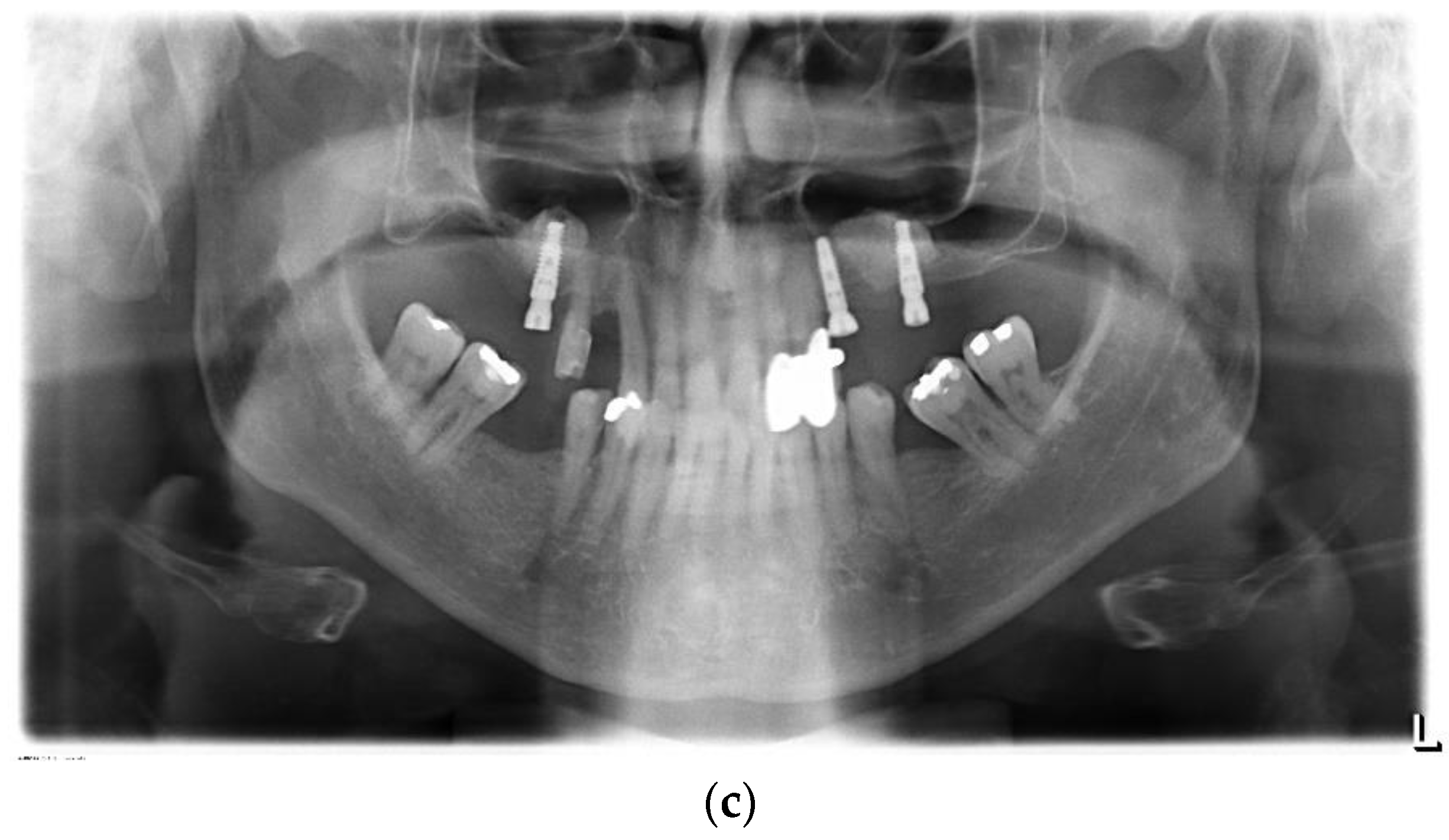 Jpm 13 00464 g005b Jpm 13 00464 g005b
