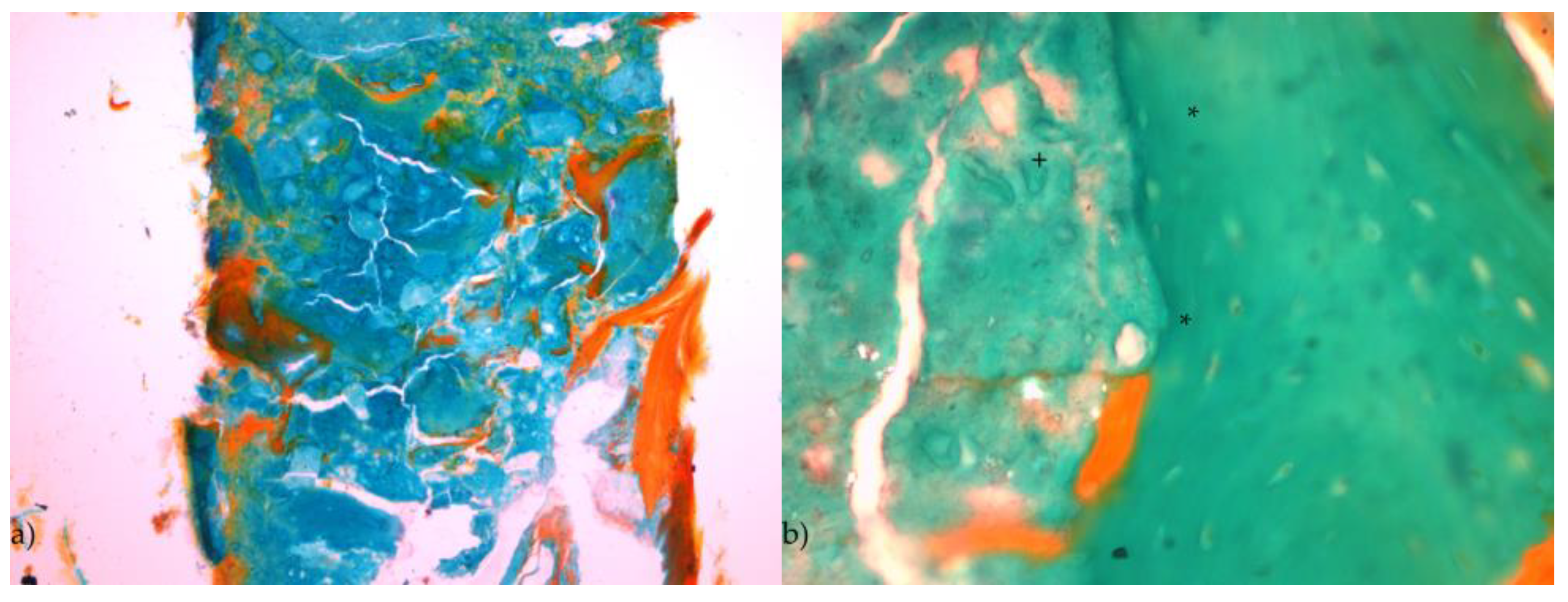 Jpm 13 00464 g006 Jpm 13 00464 g006