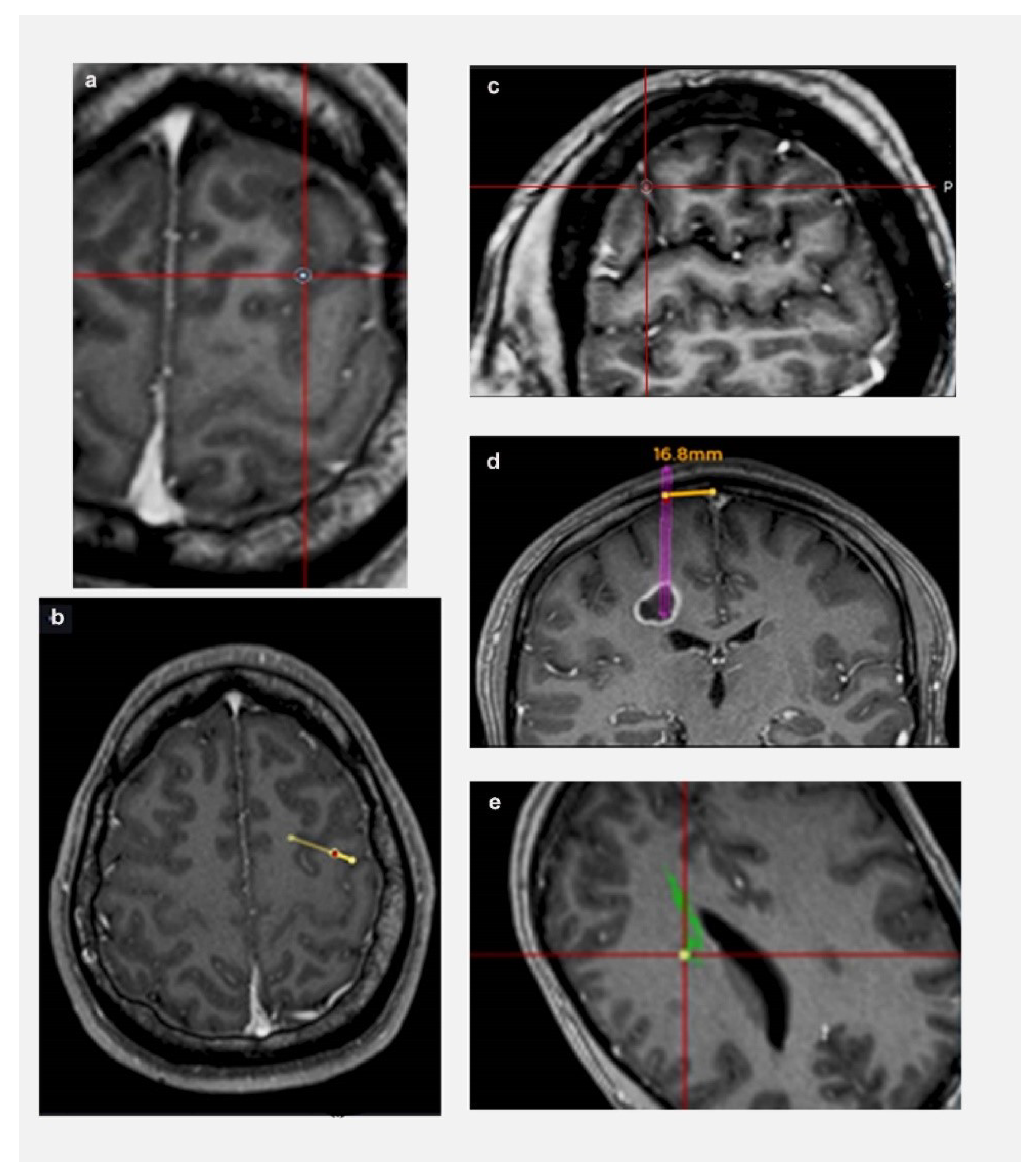 Jpm 13 00467 g001 Jpm 13 00467 g001