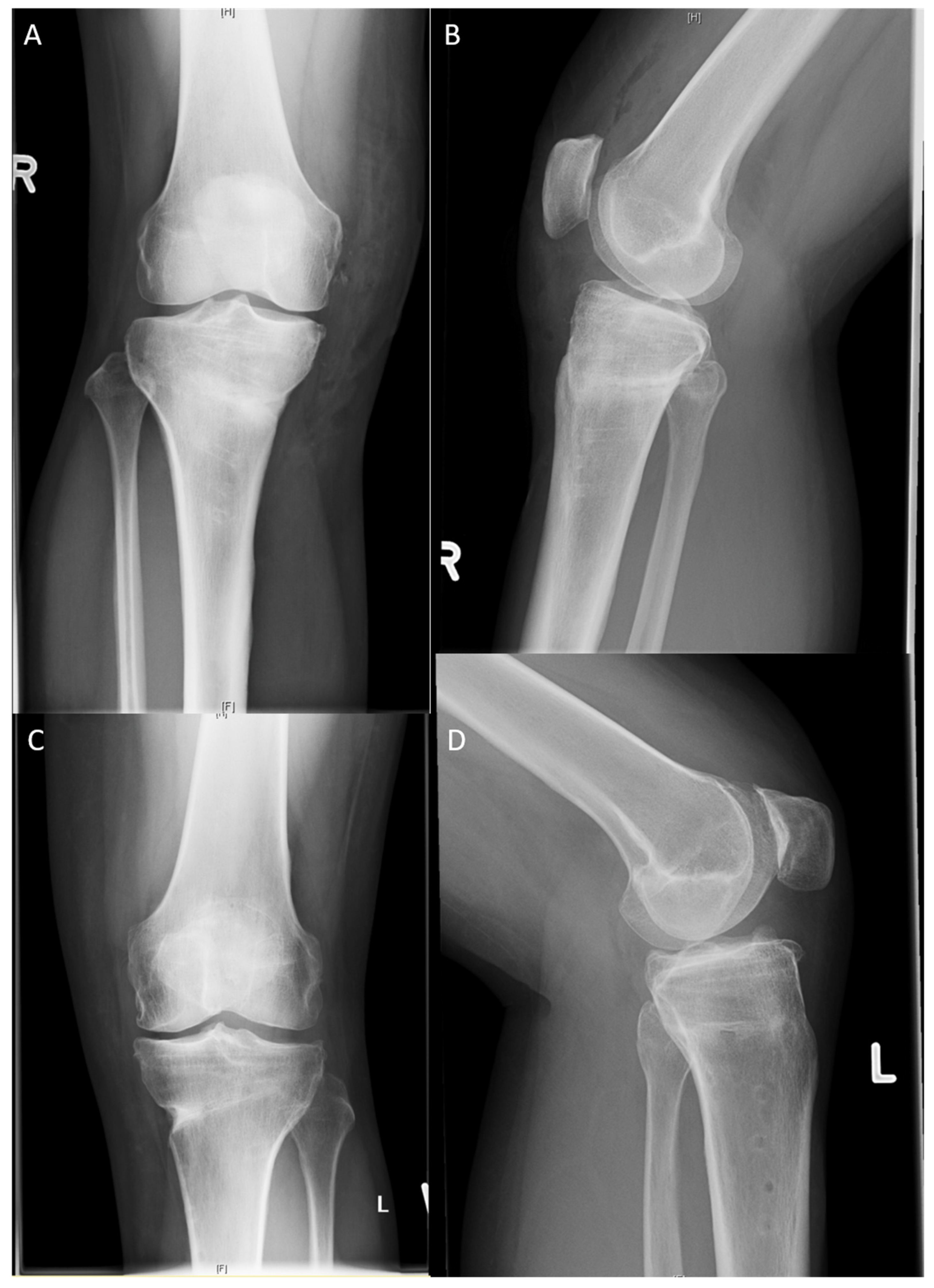 Jpm 13 00472 g006 Jpm 13 00472 g006