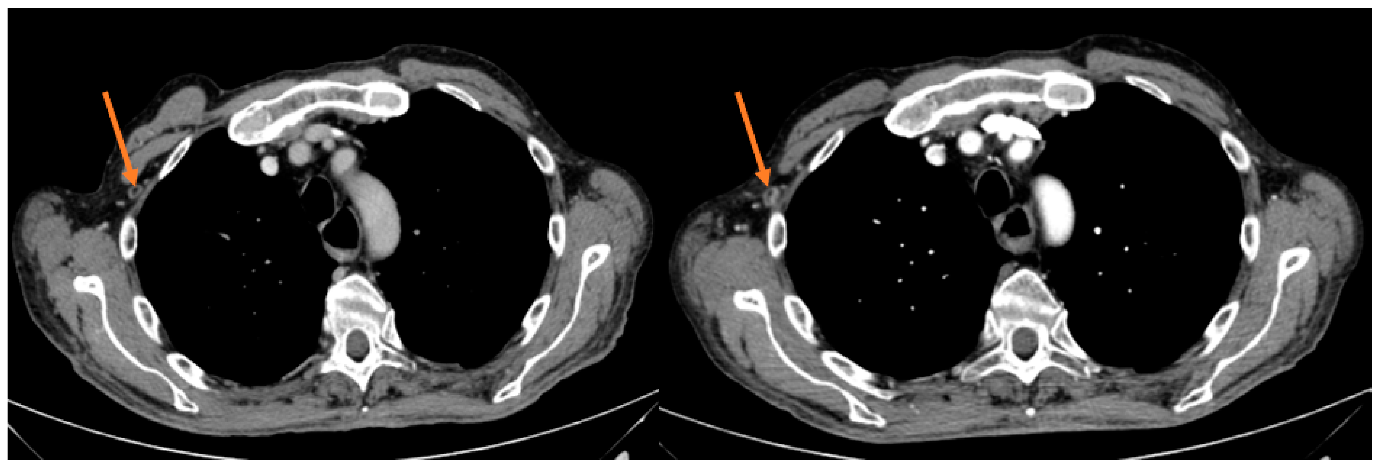 Jpm 13 00508 g002 Jpm 13 00508 g002