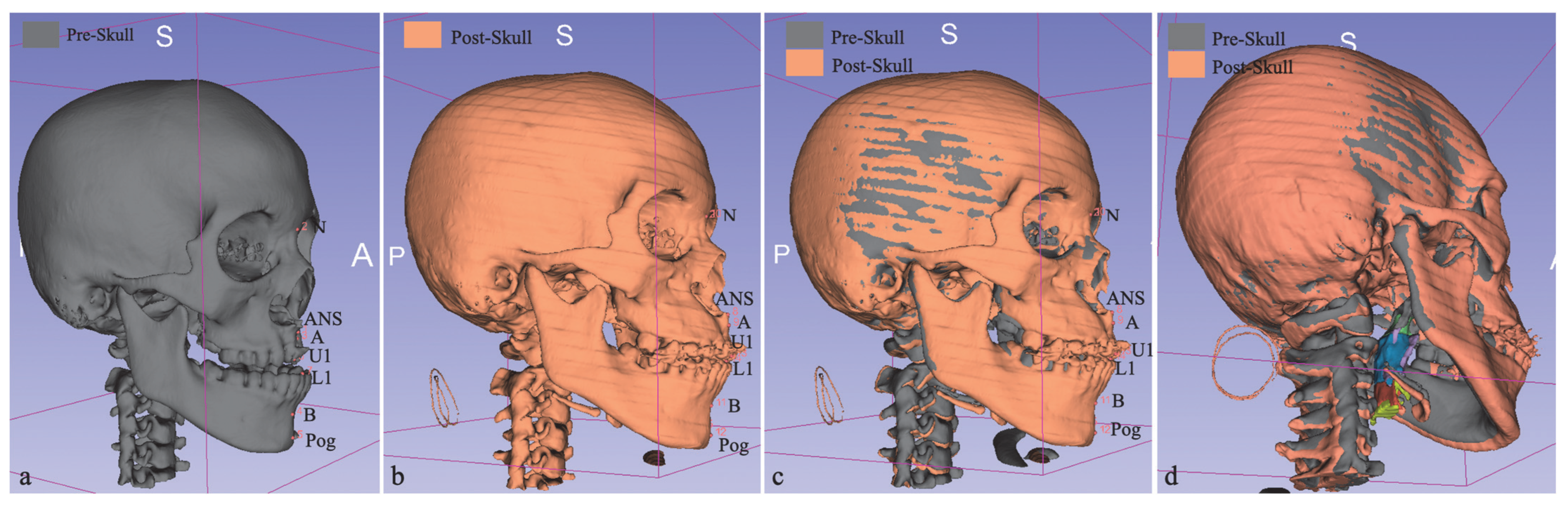Jpm 13 00543 g004 Jpm 13 00543 g004