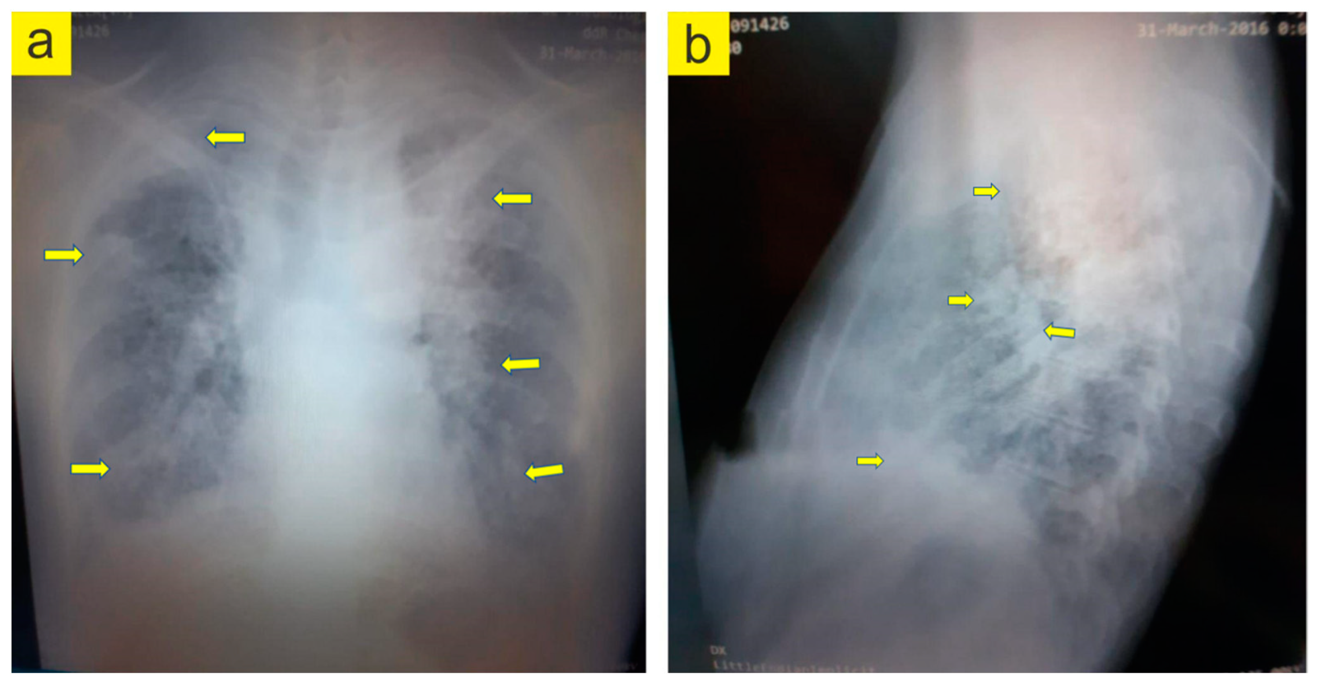Jpm 13 00607 g003 Jpm 13 00607 g003
