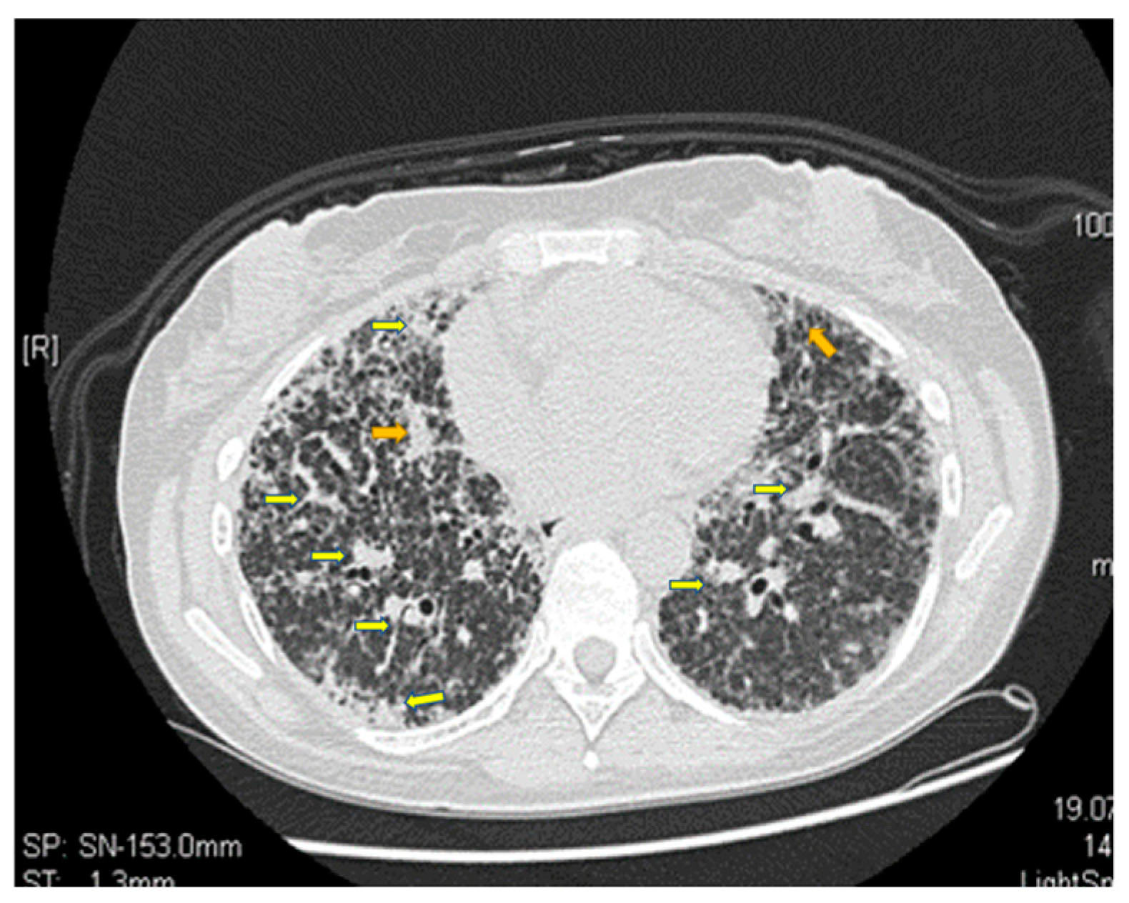 Jpm 13 00607 g004 Jpm 13 00607 g004