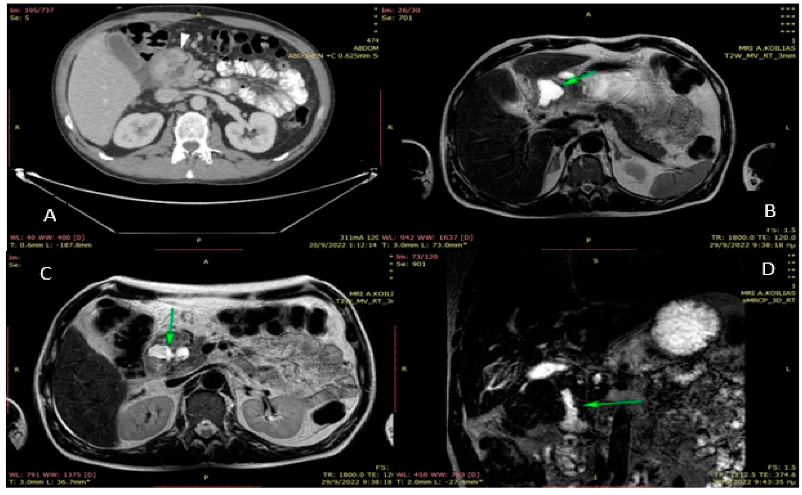 Jpm 13 00644 g002 Jpm 13 00644 g002