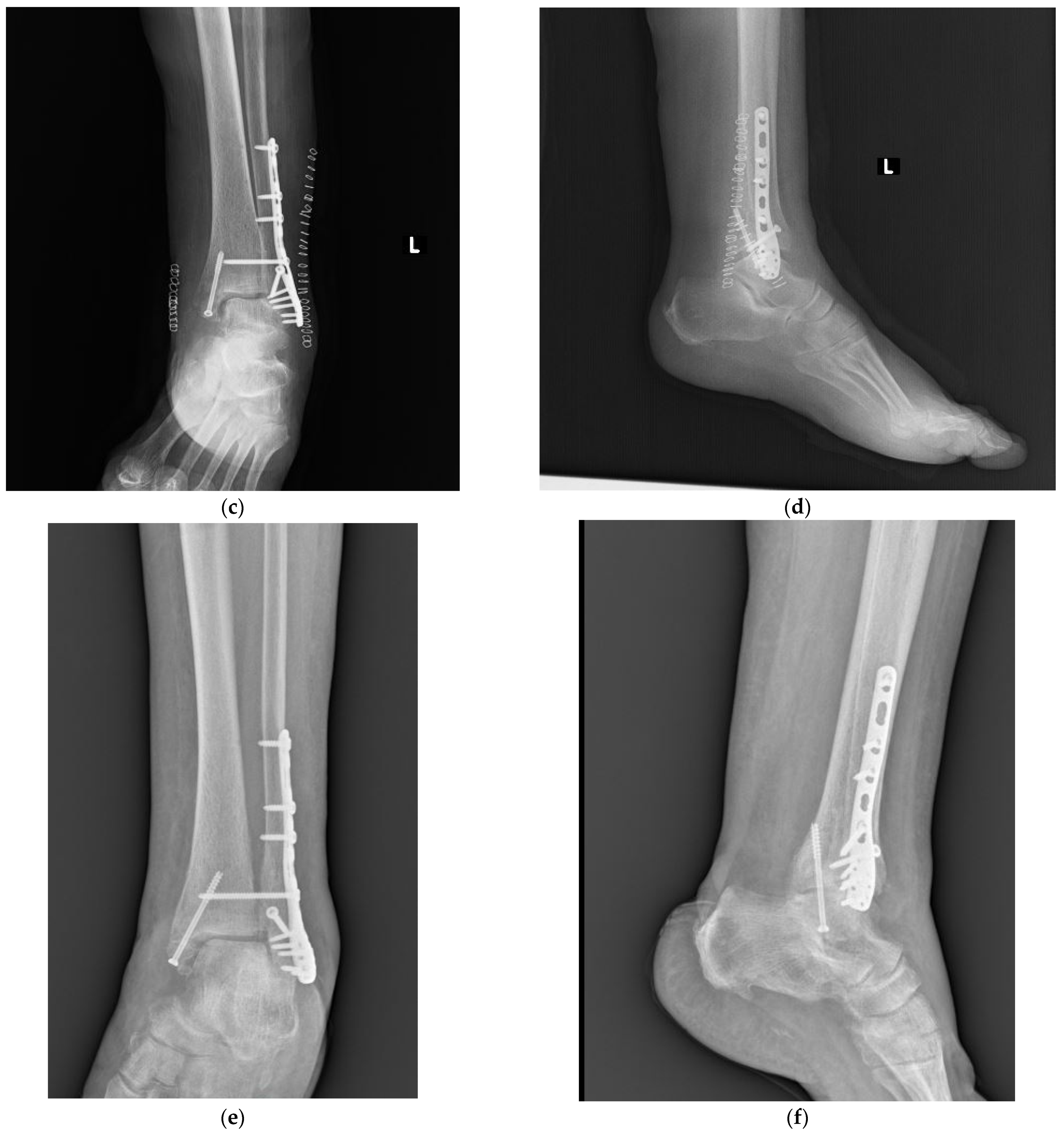 Jpm 13 00713 g002b Jpm 13 00713 g002b