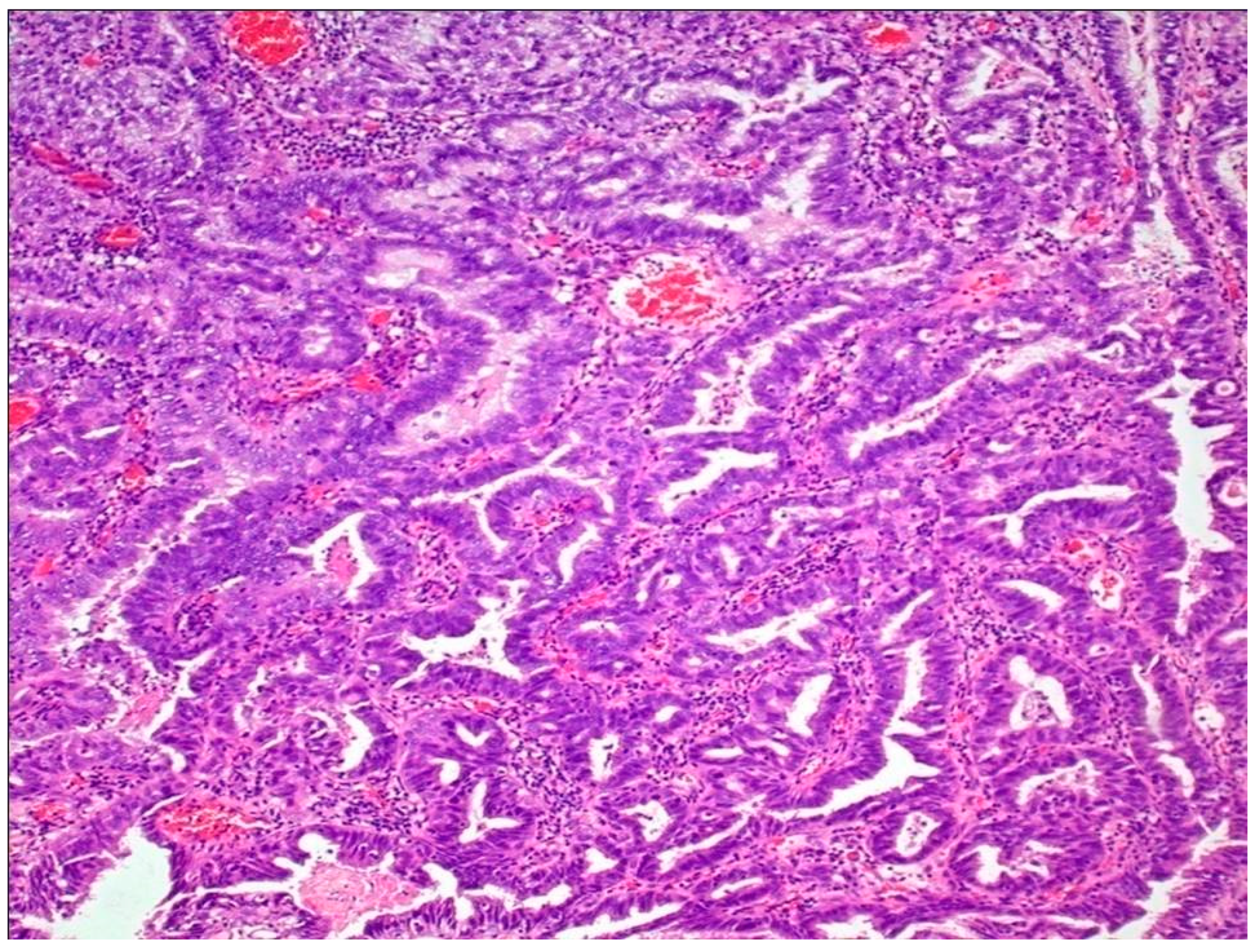 Jpm 13 00756 g005 Jpm 13 00756 g005